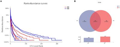 Dysbiosis of Gut Microbiota and Lipidomics of Content Induced by Dietary Methionine Restriction in Rice Field Eel (Monopterus albus)